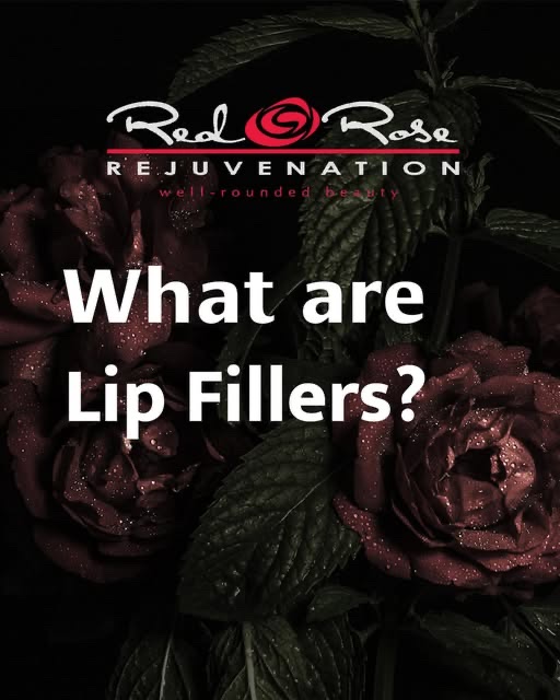 Red Rose Rejuvenation explainer graphic: What are lip fillers?