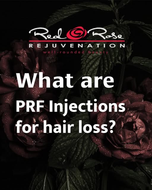 Red Rose Rejuvenation explainer graphic: PRF injections for hair loss?